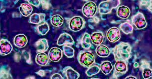 Dịch sởi bùng phát ở Texas lên đến 90 ca