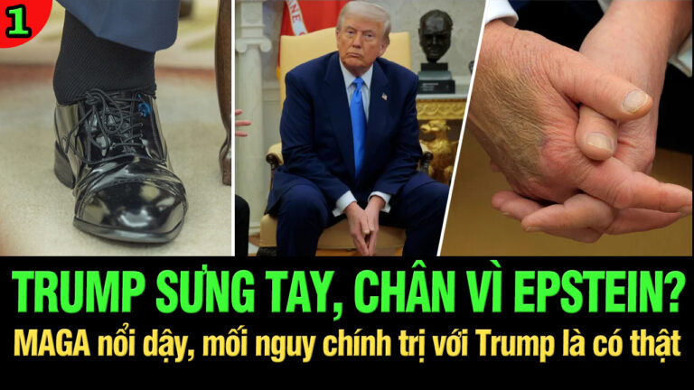 VL1-18.07: Trump sưng tay, sưng chân vì Jeffrey Epstein?