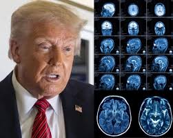 Newsom chế giễu Trump về kết quả chụp MRI ‘hoàn toàn bình thường’